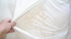 Kliješta prstiju u jastucima